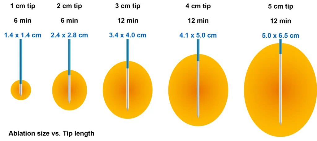 Ablation Size vs. Tip Length